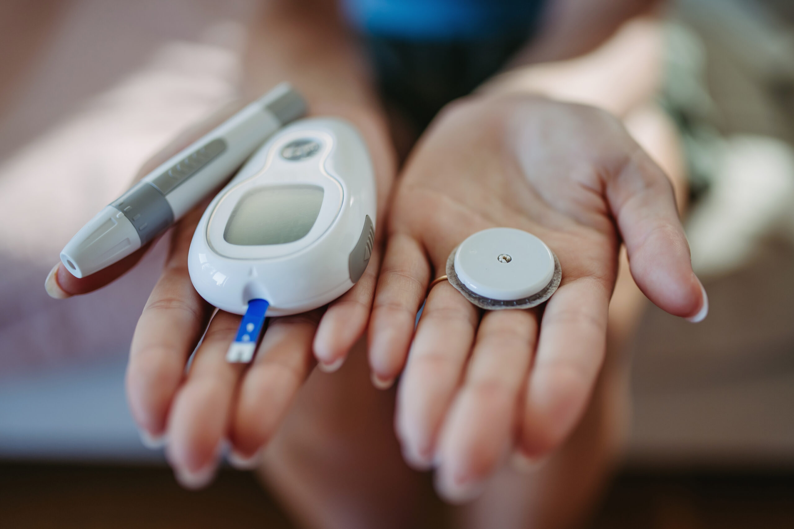 Continuous glucose monitor technology